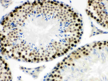 MNAT1 Rabbit Polyclonal Antibody