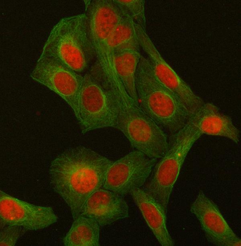 p95 NBS1/NBN Rabbit Polyclonal Antibody
