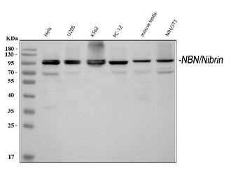 p95 NBS1/NBN Rabbit Polyclonal Antibody