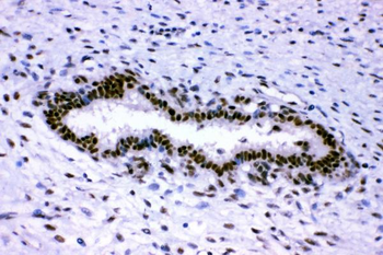 p95 NBS1/NBN Rabbit Polyclonal Antibody