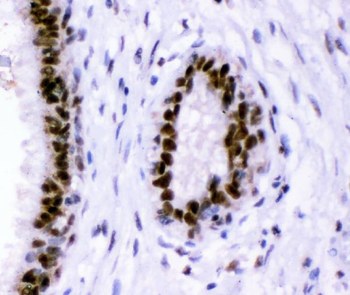 p95 NBS1/NBN Rabbit Polyclonal Antibody