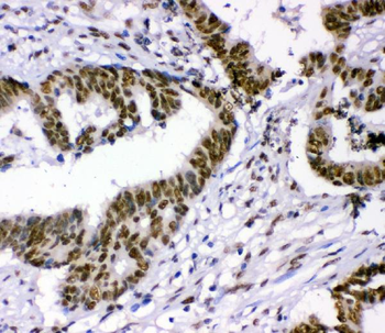 p95 NBS1/NBN Rabbit Polyclonal Antibody