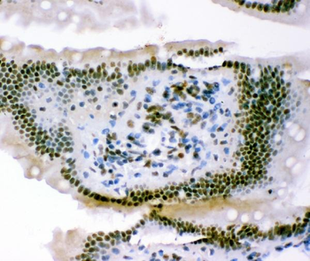 p95 NBS1/NBN Rabbit Polyclonal Antibody