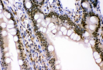p95 NBS1/NBN Rabbit Polyclonal Antibody