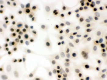 p95 NBS1/NBN Rabbit Polyclonal Antibody