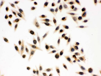 p95 NBS1/NBN Rabbit Polyclonal Antibody