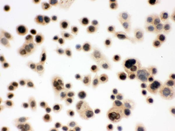p95 NBS1/NBN Rabbit Polyclonal Antibody