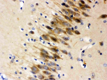 Otoferlin Rabbit Polyclonal Antibody