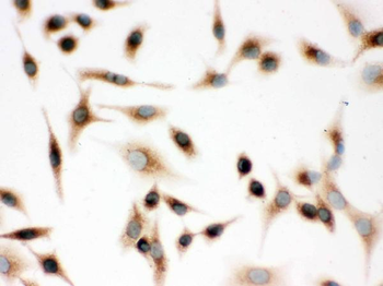 Surfactant protein D/SFTPD Rabbit Polyclonal Antibody
