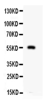 Macrophage metalloelastase MMP12 Rabbit Polyclonal Antibody