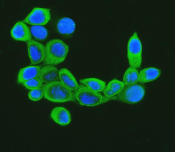 Cofilin/CFL1 Rabbit Polyclonal Antibody
