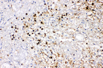 IL8/CXCL8 Rabbit Polyclonal Antibody