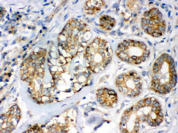 Flotillin 2/FLOT2 Rabbit Polyclonal Antibody