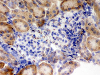Flotillin 2/FLOT2 Rabbit Polyclonal Antibody