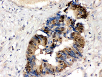 HINT1 Rabbit Polyclonal Antibody