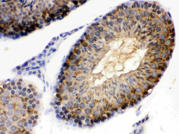 Hsp90 alpha/HSP90AA1 Rabbit Polyclonal Antibody