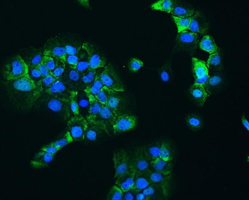 Hsp90 beta/HSP90AB1 Rabbit Polyclonal Antibody