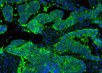 Hsp90 beta/HSP90AB1 Rabbit Polyclonal Antibody