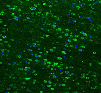 Hsp90 beta/HSP90AB1 Rabbit Polyclonal Antibody