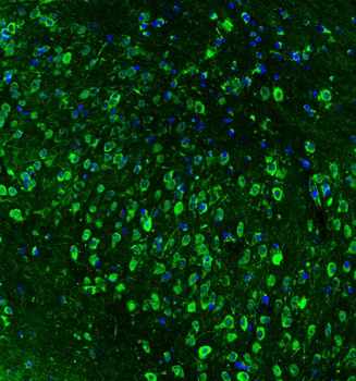 Hsp90 beta/HSP90AB1 Rabbit Polyclonal Antibody