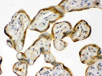 Hsp90 beta/HSP90AB1 Rabbit Polyclonal Antibody