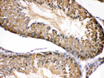 Hsp90 beta/HSP90AB1 Rabbit Polyclonal Antibody