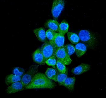 GRP94/HSP90B1 Rabbit Polyclonal Antibody