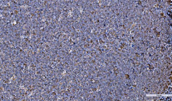 GRP94/HSP90B1 Rabbit Polyclonal Antibody