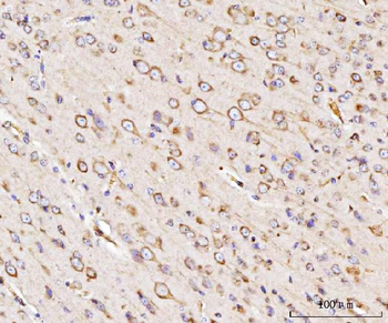 GRP94/HSP90B1 Rabbit Polyclonal Antibody