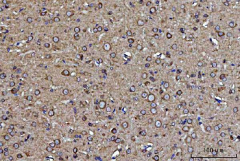 GRP94/HSP90B1 Rabbit Polyclonal Antibody