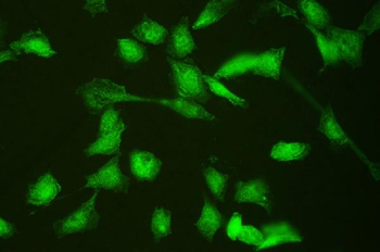 HSPA2 Rabbit Polyclonal Antibody