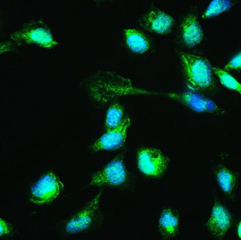 HSPA2 Rabbit Polyclonal Antibody