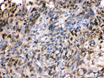 HSPA2 Rabbit Polyclonal Antibody