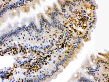 HSPA2 Rabbit Polyclonal Antibody