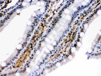 HSPA2 Rabbit Polyclonal Antibody