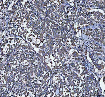 GRP78 BiP/HSPA5 Rabbit Polyclonal Antibody