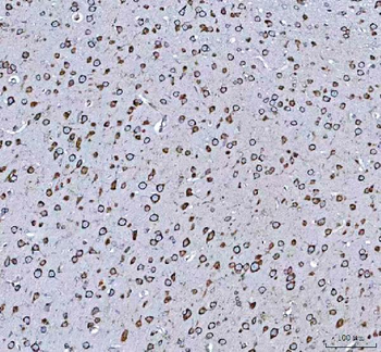 GRP78 BiP/HSPA5 Rabbit Polyclonal Antibody