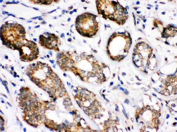 Hsc70/HSPA8 Rabbit Polyclonal Antibody