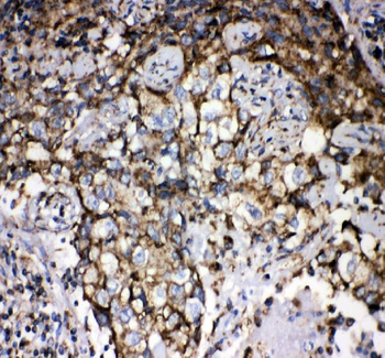 Grp75/HSPA9 Rabbit Polyclonal Antibody