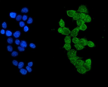 Ikaros/IKZF1 Rabbit Polyclonal Antibody