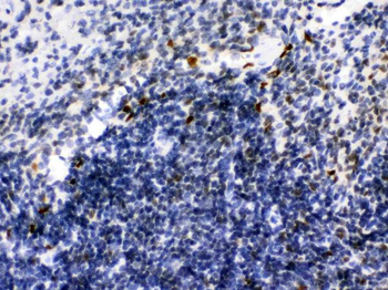 Ikaros/IKZF1 Rabbit Polyclonal Antibody