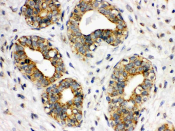 CD41/Integrin alpha 2b/ITGA2B Rabbit Polyclonal Antibody