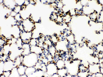 CD41/Integrin alpha 2b/ITGA2B Rabbit Polyclonal Antibody