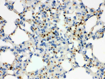 CD41/Integrin alpha 2b/ITGA2B Rabbit Polyclonal Antibody