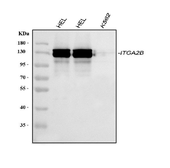 CD41/Integrin alpha 2b/ITGA2B Rabbit Polyclonal Antibody
