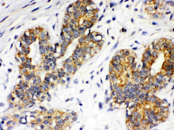 Integrin alpha 4/ITGA4 Rabbit Polyclonal Antibody