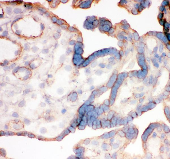Integrin alpha 4/ITGA4 Rabbit Polyclonal Antibody