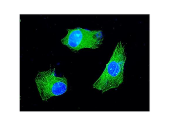 KChIP2/KCNIP2 Rabbit Polyclonal Antibody