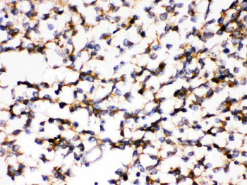 KChIP2/KCNIP2 Rabbit Polyclonal Antibody