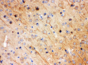 KChIP2/KCNIP2 Rabbit Polyclonal Antibody
